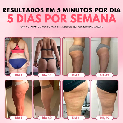 AlluShape 2.0 - Potente redutor de Gordura Localizada, Celulite e Lipedema.