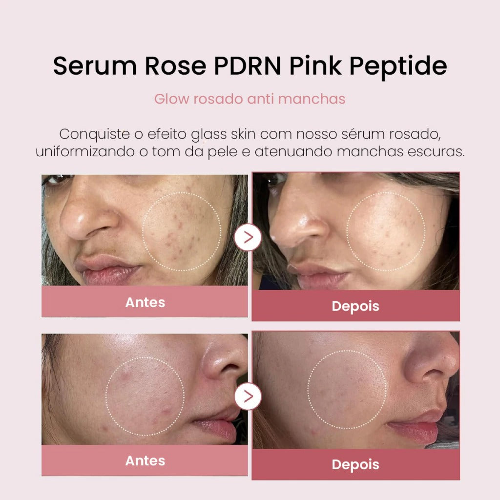 Sérum PDRN de Peptídeos Rosa