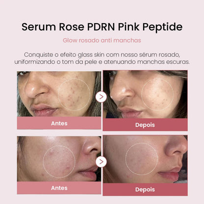 Sérum PDRN de Peptídeos Rosa